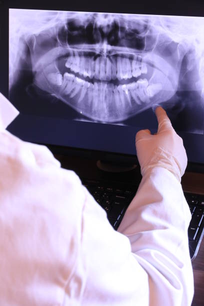 Best Emergency Root Canal Treatment in Savage, MN