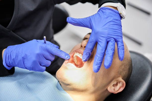 Best Emergency Denture Repair in Savage, MN